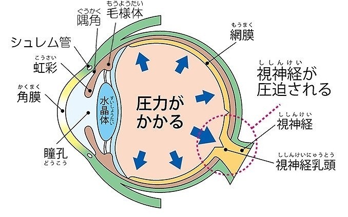 圧 方法 下げる 眼 を